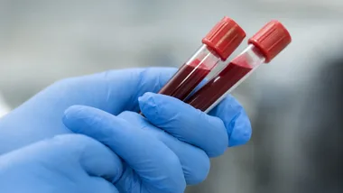 Od probówki do wyniku. Tak działa diagnostyka w legnickim szpitalu